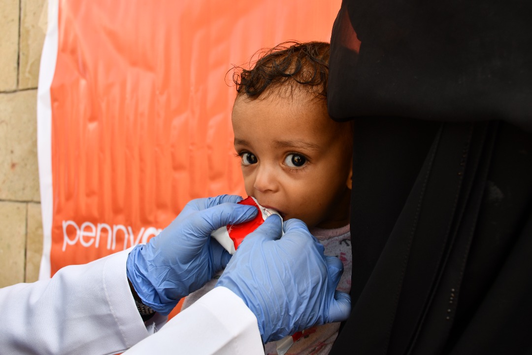 بتمويل من منظمة بيني أبيل أستراليا تقديم خدمات التغذية المتكاملة وصحة الأم والطفل في محافظة تعز