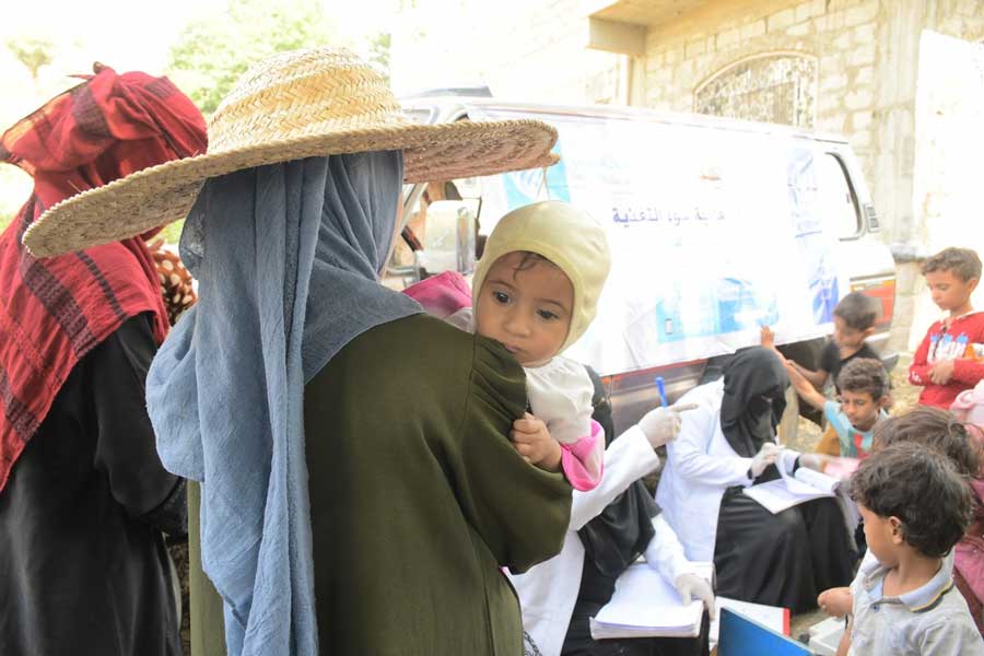 Malnutrition.. kills Yemeni children